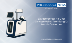 Extracorporeal HIFU for Varicose Veins: Promising 12-Month Outcomes
