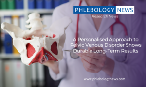 Phlebology News:A Personalised Approach to Pelvic Venous Disorder Shows Durable Long-Term Results