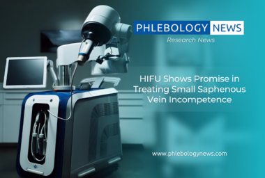 Phlebology News: HIFU Shows Promise in Treating Small Saphenous Vein Incompetence