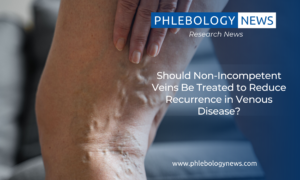 Should Non-Incompetent Veins Be Treated to Reduce Recurrence in Venous Disease?